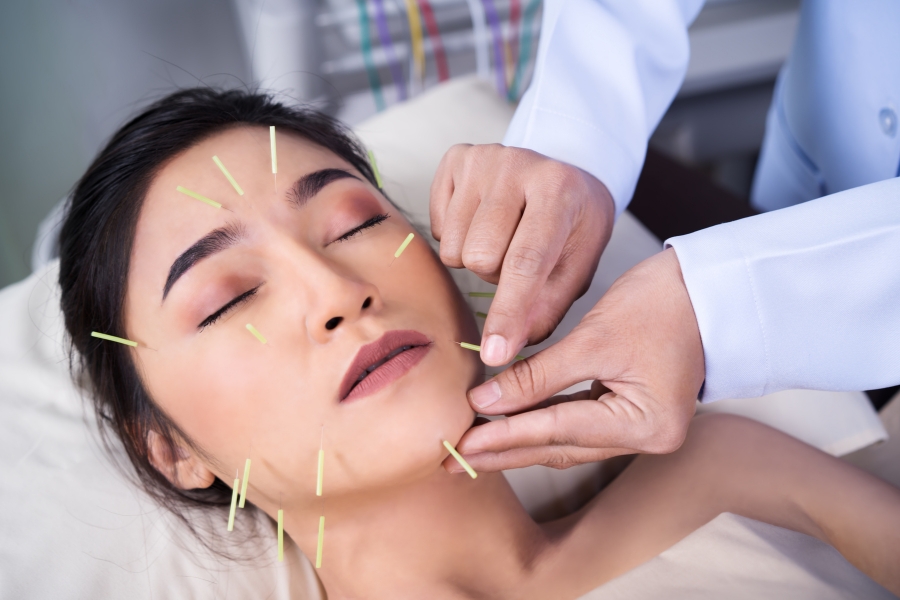 How Acupuncture Helps Reduce Pain and Inflammation