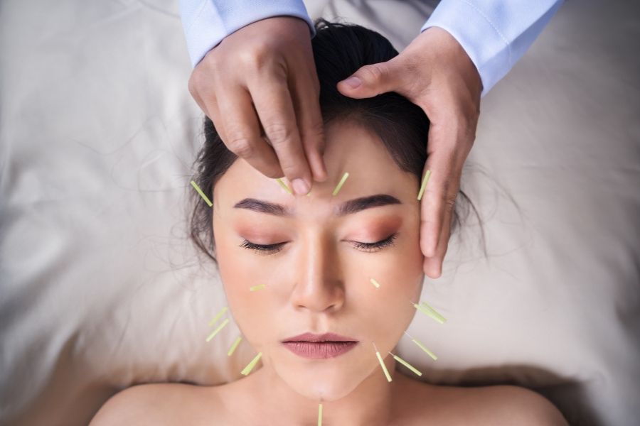 How Acupuncture Works and Why It Helps You Heal