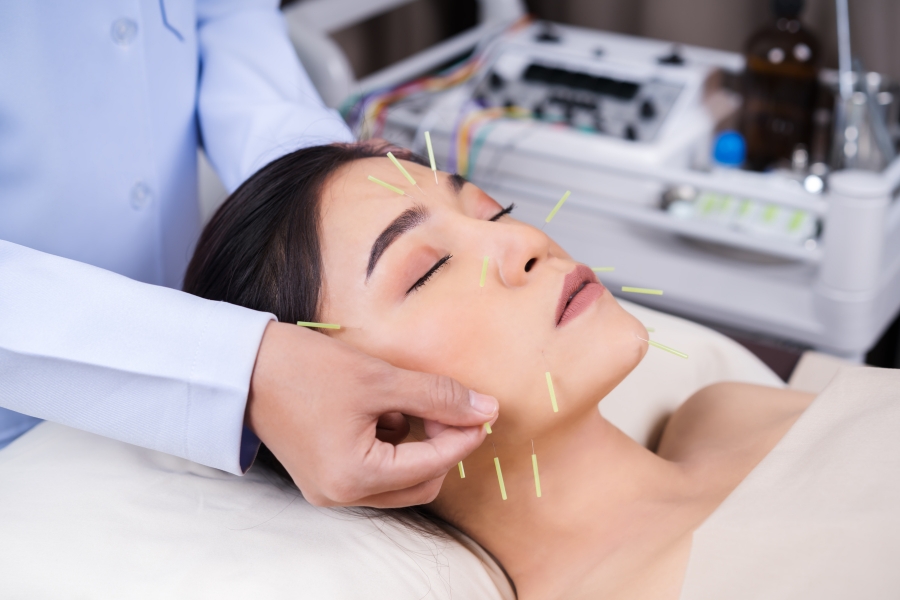 Why Physician-Led Acupuncture Matters